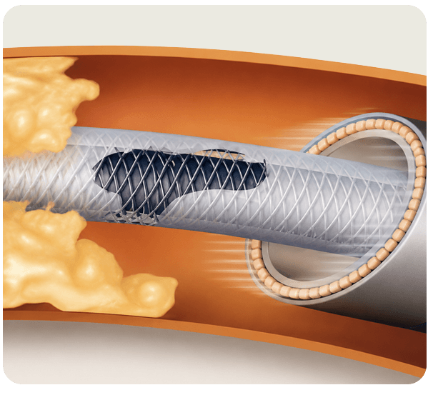 What-Lead-Extraction-Is